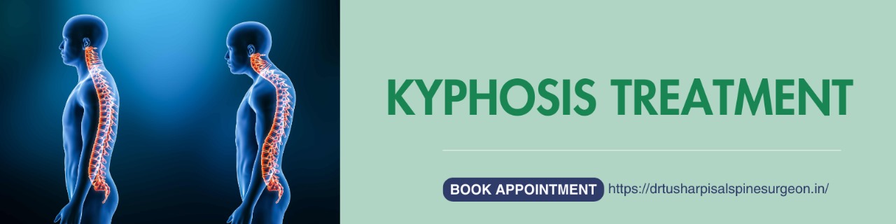 Kyphosis Treatment