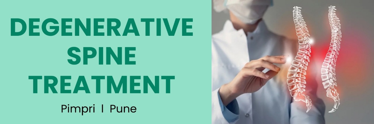 Degenerative Spine Treatment
