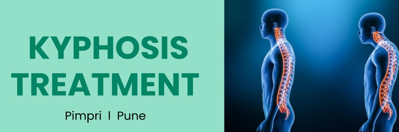 Kyphosis Treatment