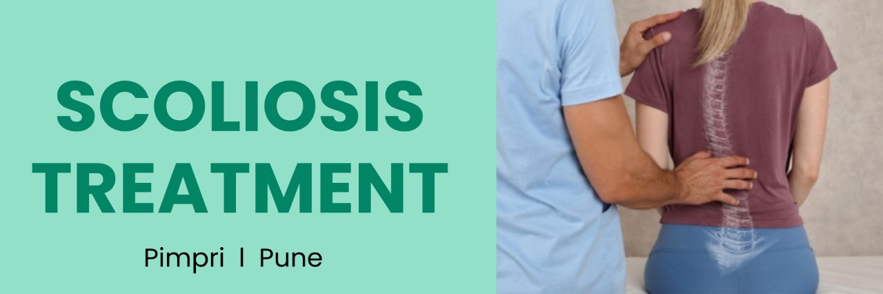Scoliosis Treatment