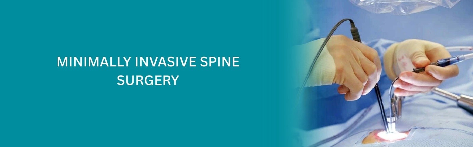 Minimal Invasive Spine Surgery