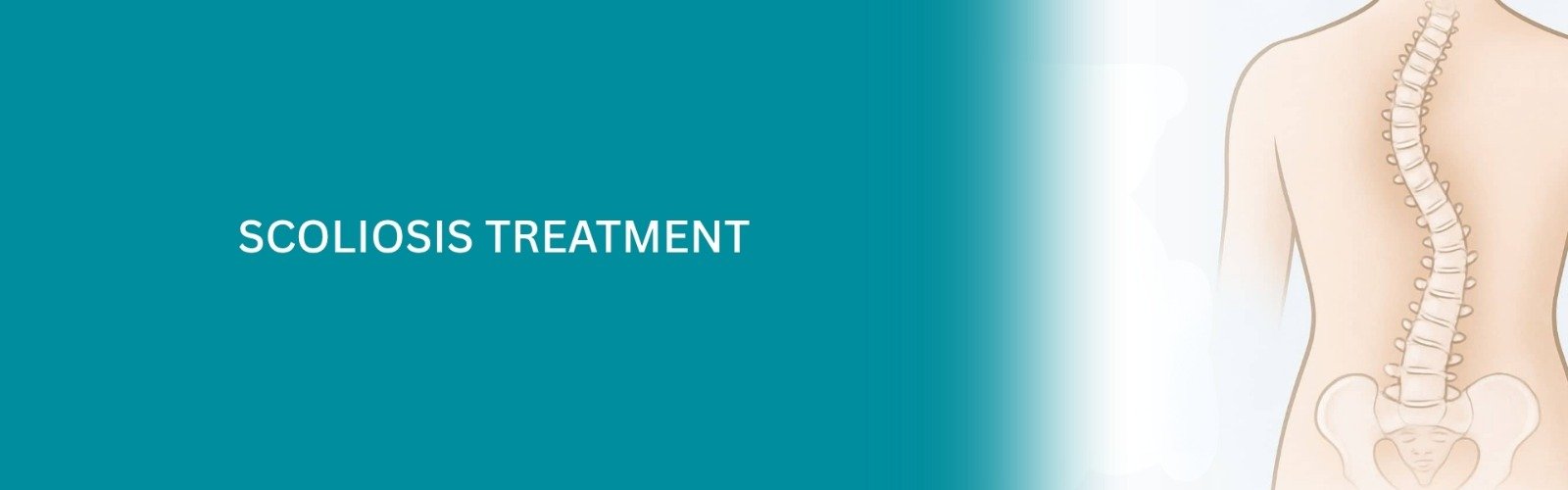 Scoliosis Treatment